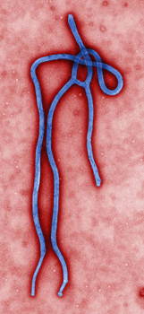 Ebola virus
