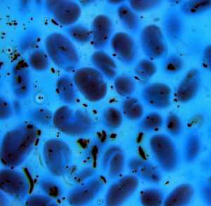 Bacteria (Image from www.freeimages.co.uk)