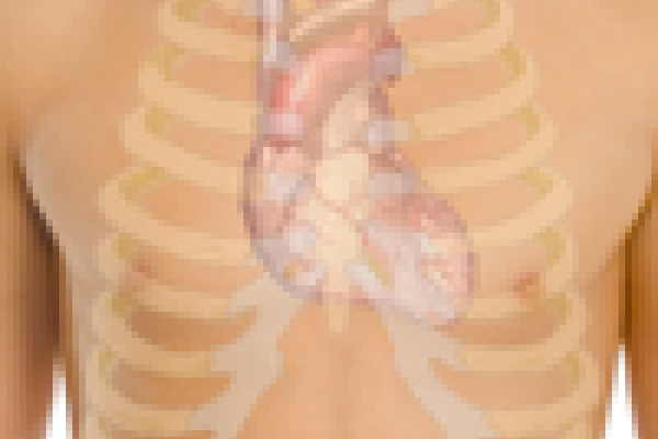 replacement heart valves